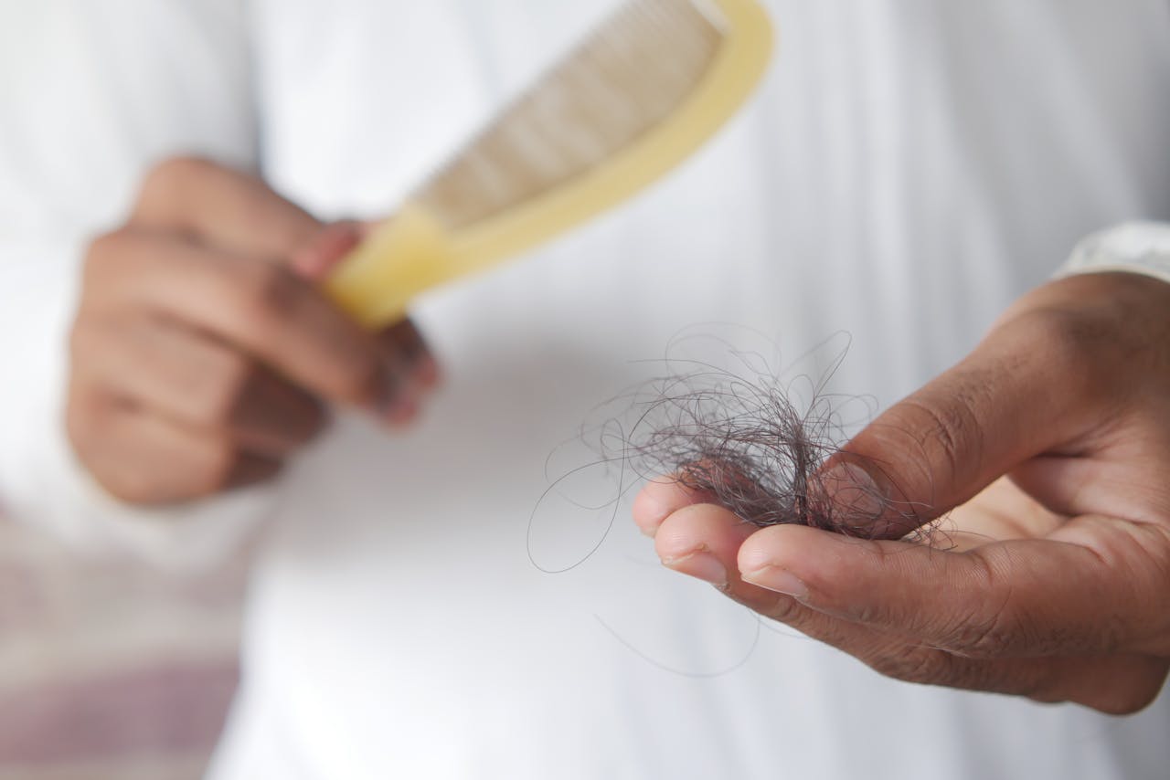 15 Factors That Could Be Speeding Up Hair Loss (and What You Can Do About It) <p> Hair loss can be a distressing experience for many, and it’s not just aging that causes it. While genetics play a role, there are several other factors that might be speeding up your hair loss without you realizing it. Whether it's your lifestyle, health, or hair care routine, understanding these influences can help you take steps to slow or even reverse hair loss. Below are 15 factors that could be contributing to your hair thinning—and what you can do to address them. </p> :: Pexels