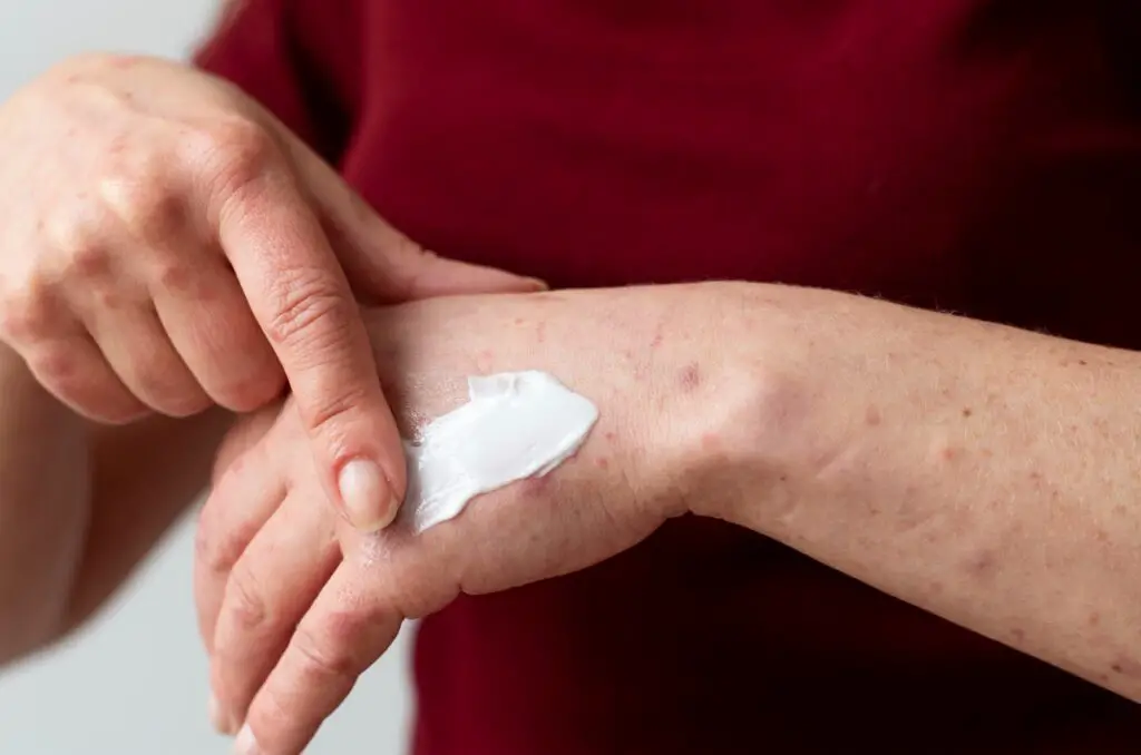 <p> Dry skin, brittle hair, and weak nails can be signs of essential fatty acid or vitamin E deficiency. Vitamin E is a powerful antioxidant that helps maintain the health of skin, hair, and nails. Without it, you may notice your skin becoming dry, flaky, and irritated. Essential fatty acids like omega-3s are also vital for maintaining healthy skin and hair, and their deficiency can cause skin problems and dry, brittle hair. If your skin or hair is constantly dry, you may need to increase your intake of vitamin E and omega-3-rich foods like fish, nuts, and seeds. Ensuring that you’re getting these essential nutrients can help restore moisture and strength to your skin, hair, and nails. </p> :: Freepik