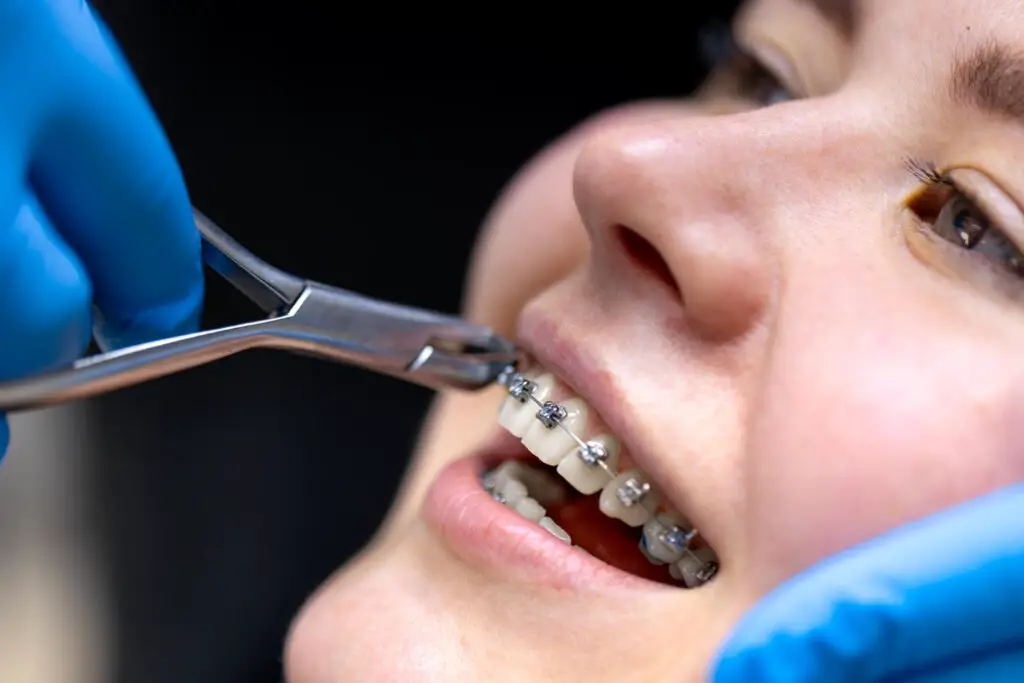 <p> For many kids, braces were a luxury their families couldn’t afford. Fast forward to adulthood, and finally being able to invest in a straighter smile is more than just cosmetic—it’s empowering. Not only does it boost confidence in photos and social settings, but it also improves dental health long term. There is something incredibly rewarding about finally fixing what you once had no control over. </p> :: Pexels